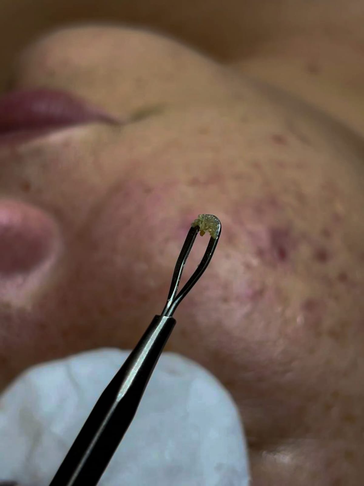 Ritual de cuidado facial na Solei
